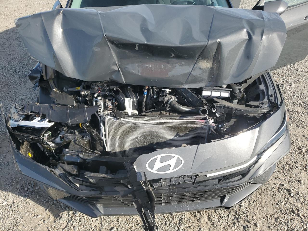 Hyundai ELANTRA Se Image 12